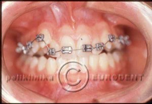 ortodoncija_2 (1)